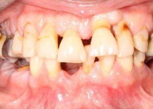 loose_teeth-1-450x322
